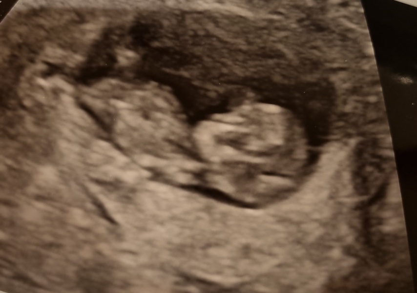 June 2023 Babies ☀️ (thread two)