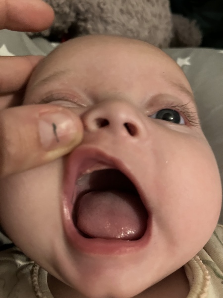 4 month old cutting top lateral incisors? 