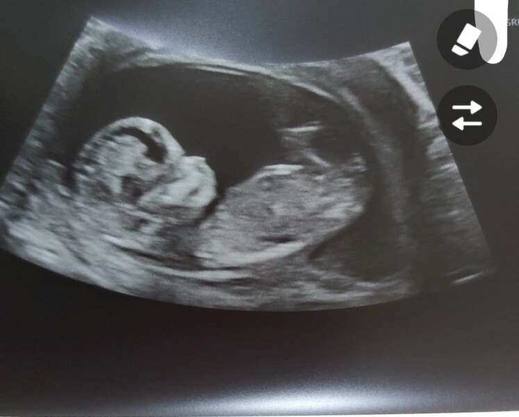 Any ideas on gender