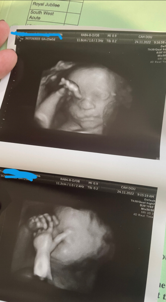 Due March 2023 - thread 5
