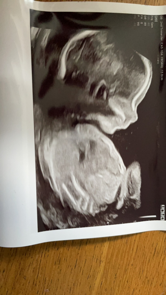 Due March 2023 - thread 4