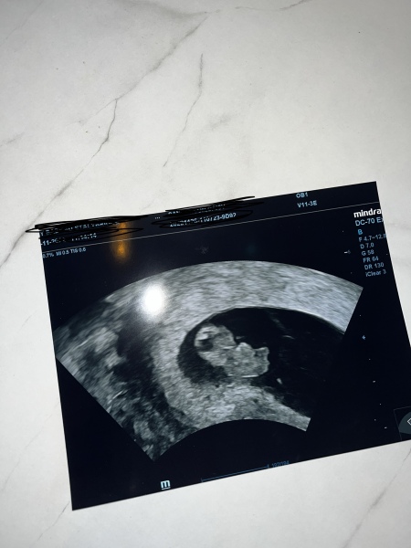 June 2023 Babies ☀️ (thread two)