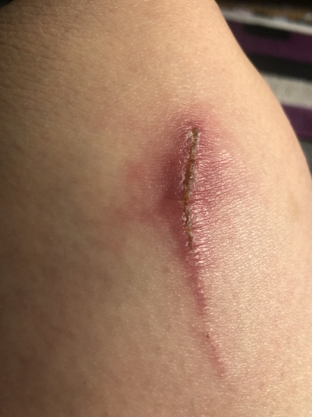 AIBU or is this infected *TW photo inc! 
