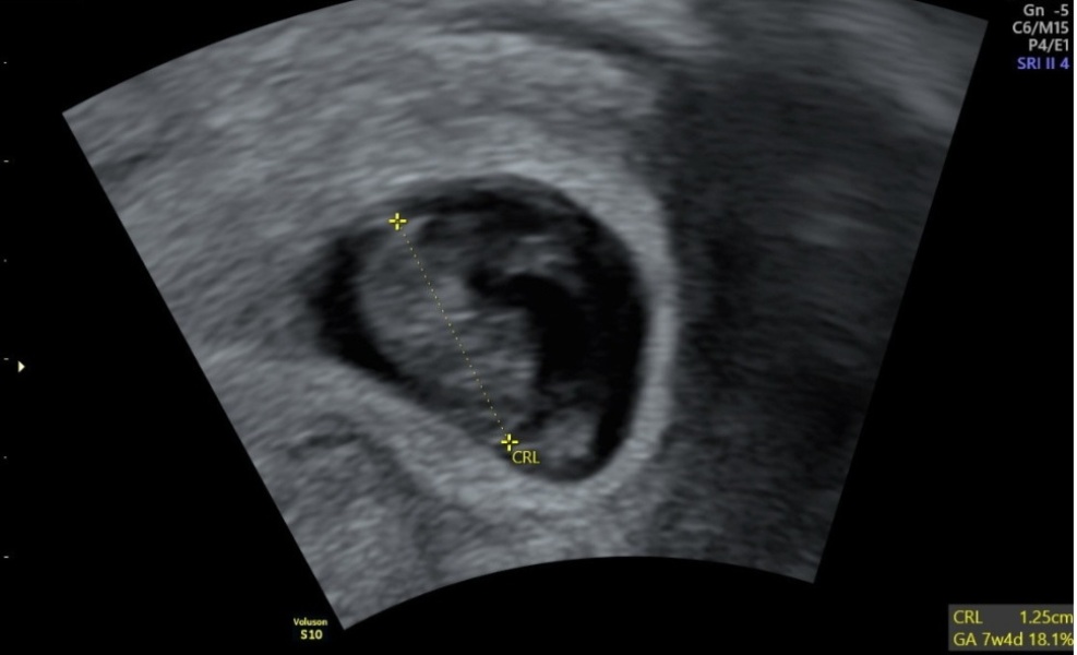 Any gender guesses?