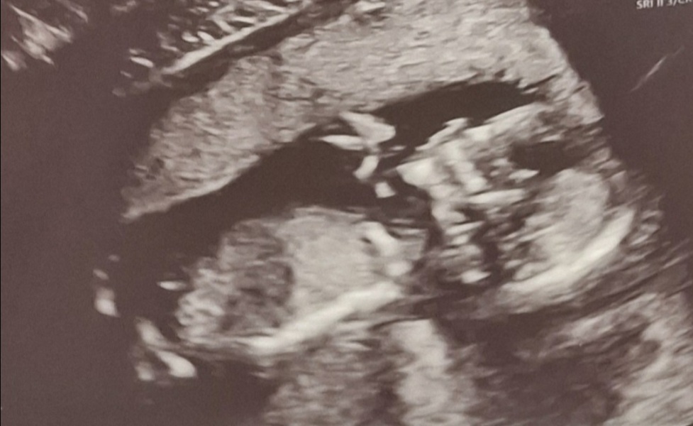 Boy or girl?