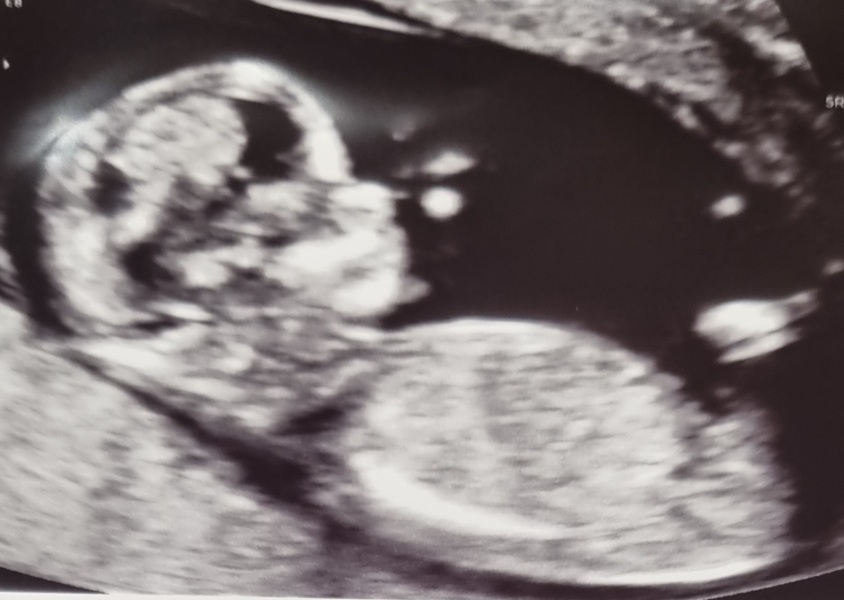 Any gender guesses?