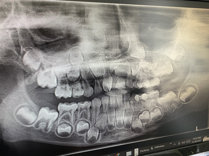 Any dentists make sense of this X-ray? 