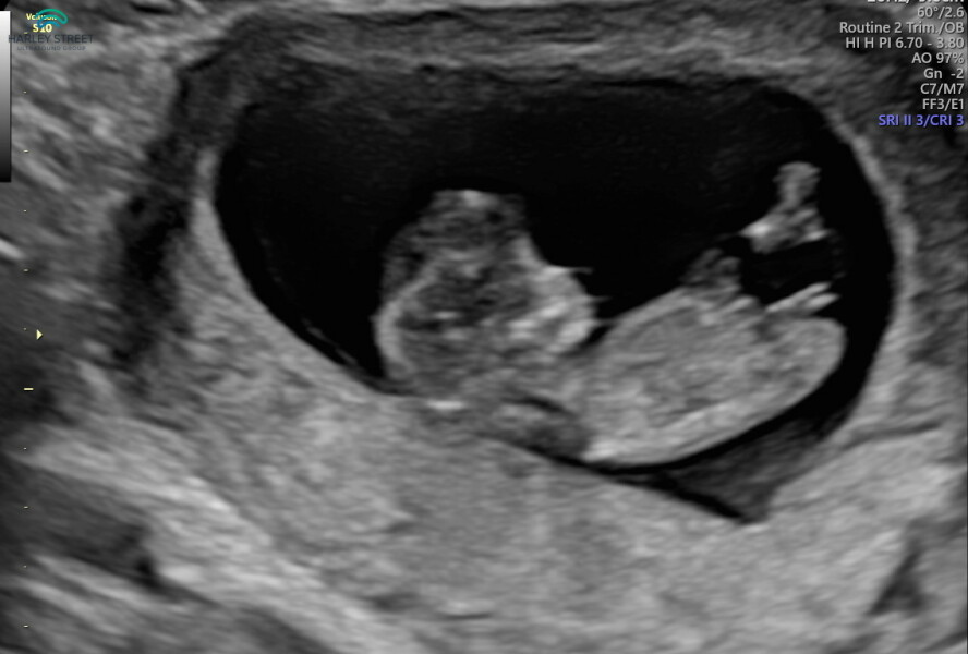 June 2023 Babies ☀️ (Thread 3) 