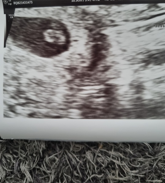 Due July 2023