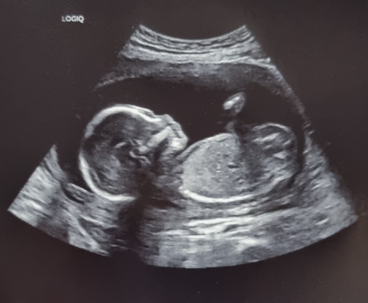 Due March 2023 - thread 4