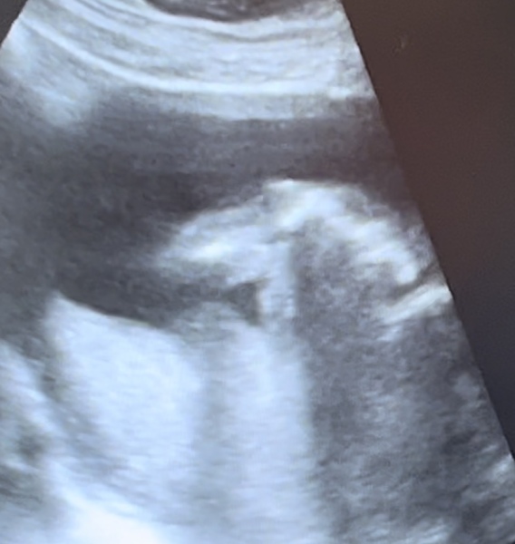 Is this a boy or girl?