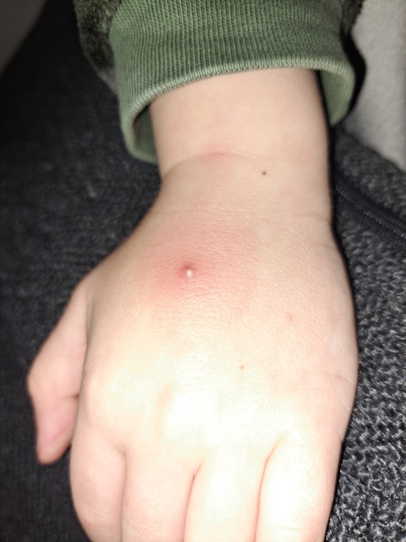 What's this on hand?