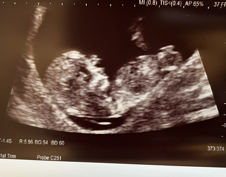 Any gender guesses?