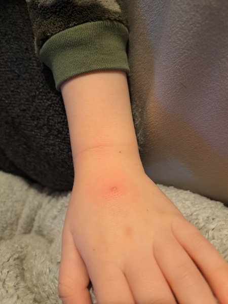 What's this on hand?