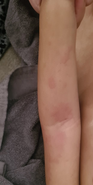 Viral Skin Rash or something else?
