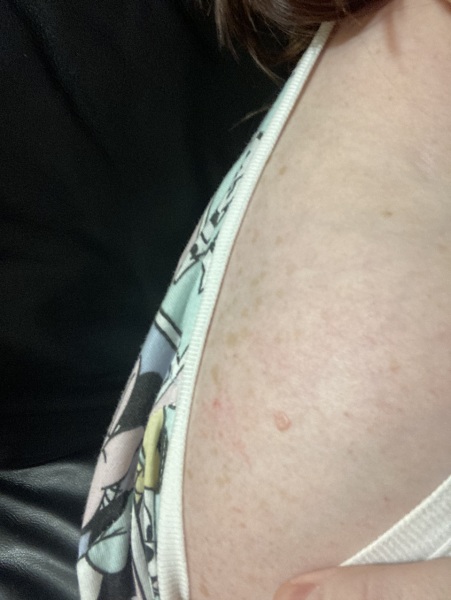 Little skin growth