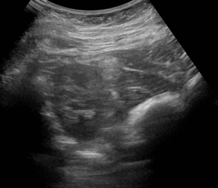 Due May 2023 - thread two