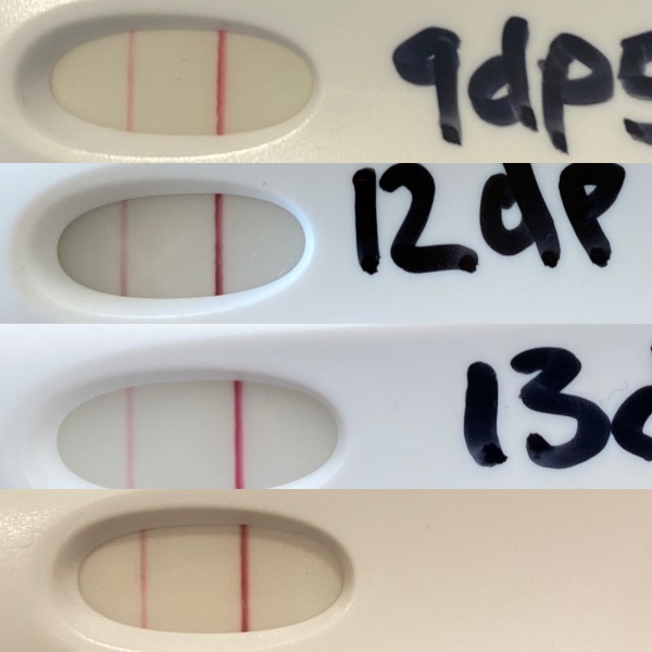 In Limbo poor progress in early pregnancy