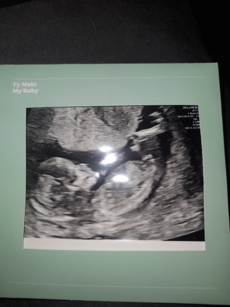 any ideas on what gender it is?