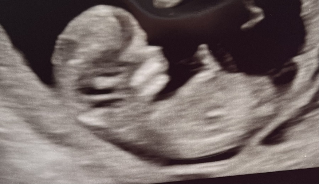 Scan pic- nub theory gender guesses for fun 💜💚