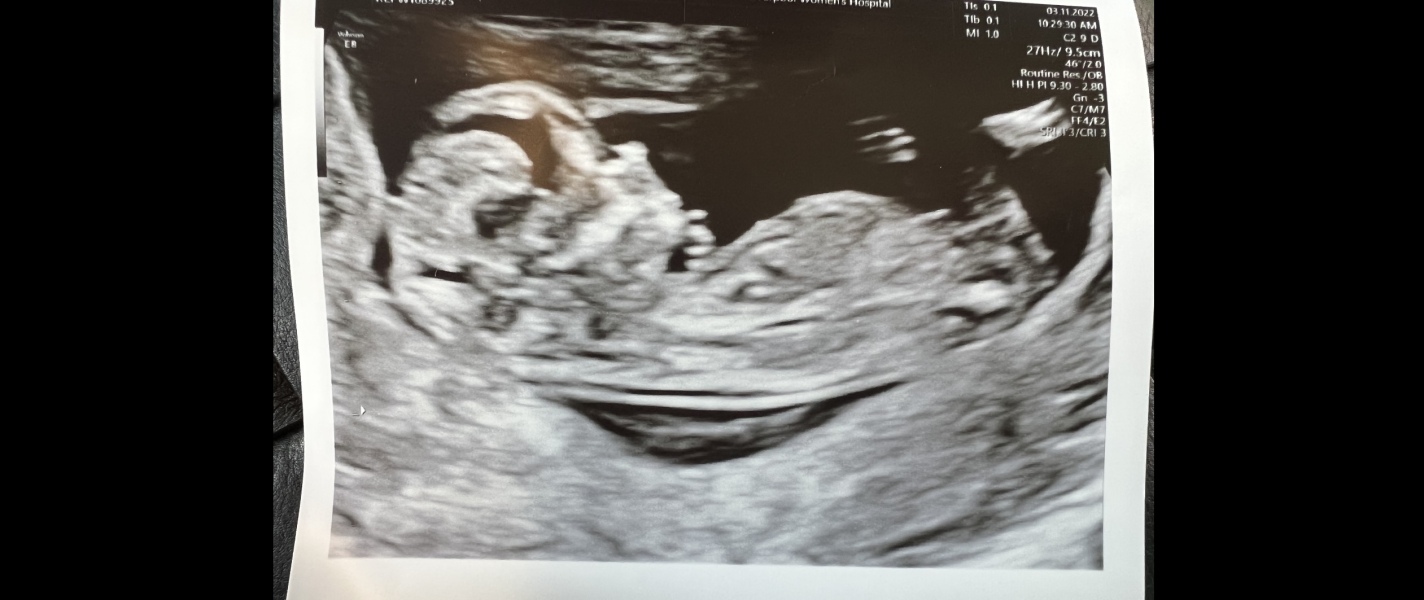 Due May 2023 - thread two