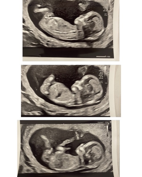 Gender Predictions Please!! 🙏