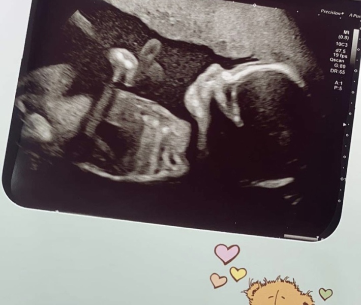 Due March 2023 - thread 4