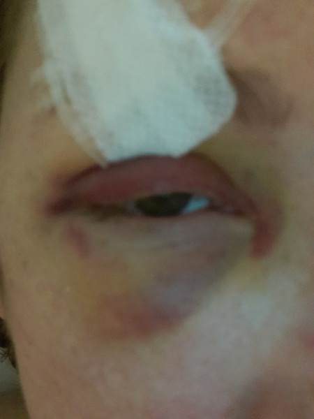 To ask if this needs an x Ray?