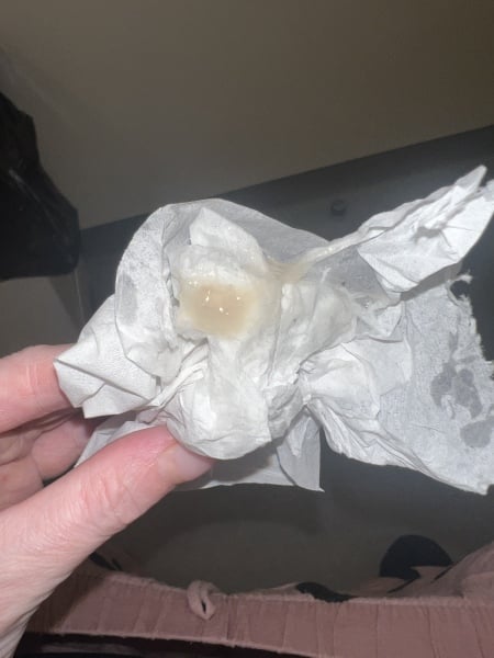 Is this mucus plug 