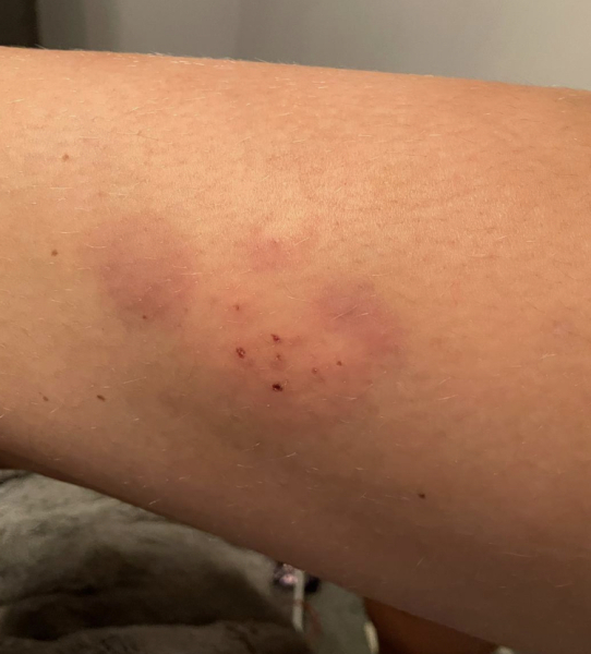 What does this look like (pic)