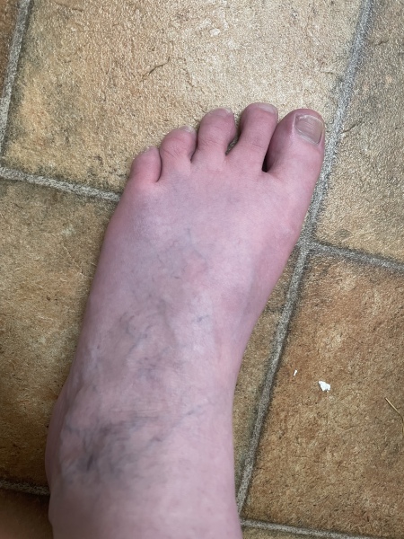 Could this be a blood clot? 