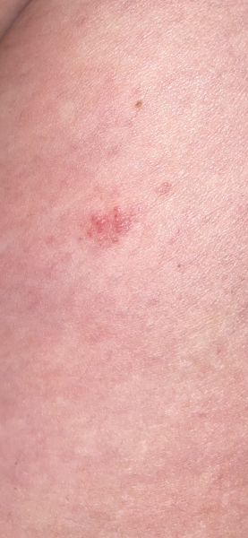 Weird spots/rash