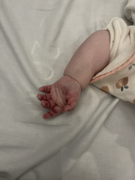 Mass on brain 4 month old baby