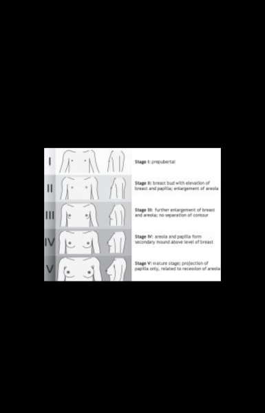 Does anyone here have breast asymmetry? 