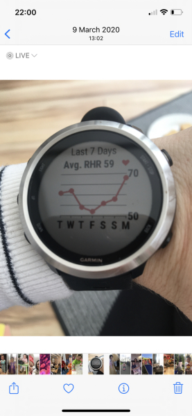 RHR dip a sign of implantation or AF?