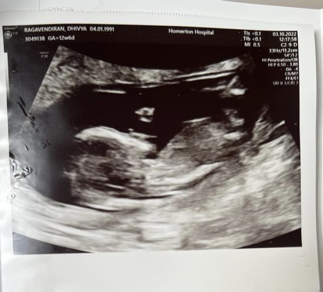 Any gender guesses?