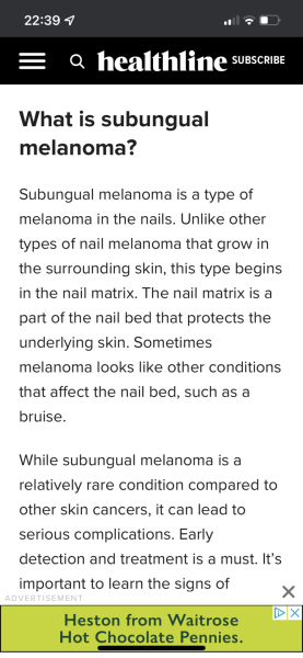 What's this on my nail?