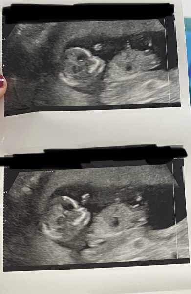 💗Gender Guesses💙