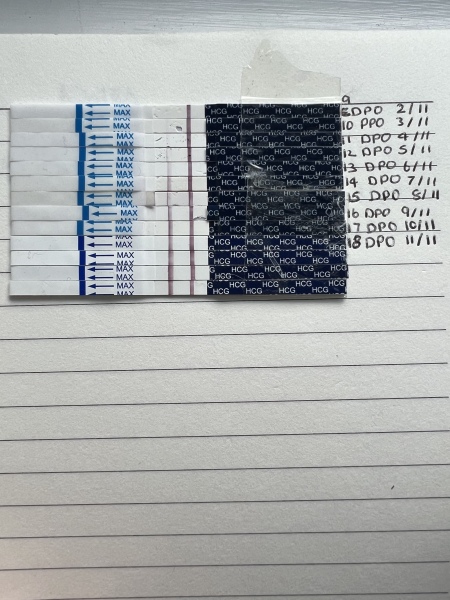 Short luteal phase?