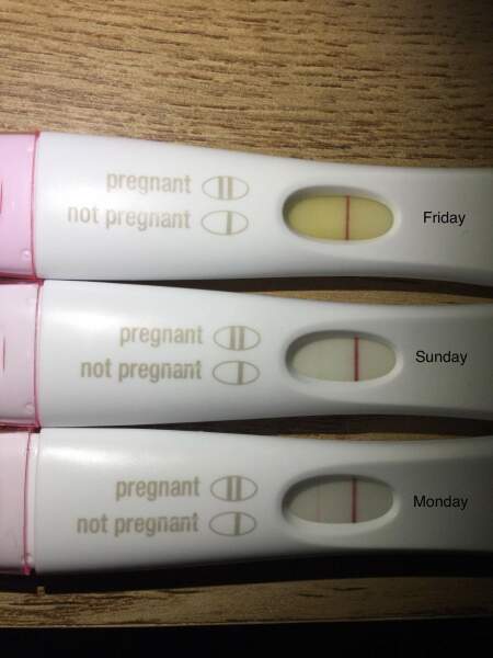 What IVF dose and how many eggs did you get?