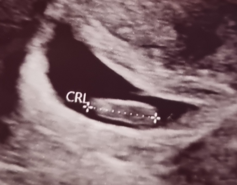 June 2023 Babies ☀️ (thread two)