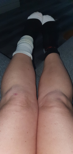 Fell on Thursday it's got worse by tonight