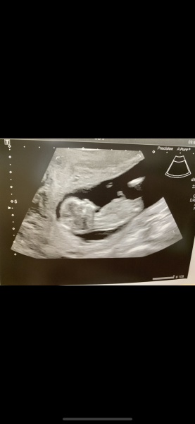 Girl or boy? 