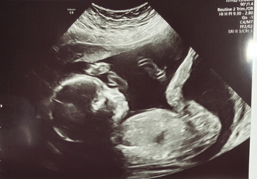 April 2023 - We’re nearly half way! ✨ 🍼