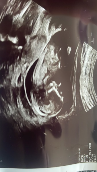 Scan pic- nub theory gender guesses for fun 💜💚