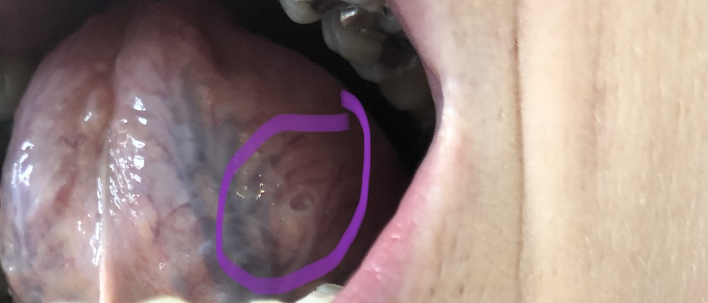 Is anyone a qualified dentist on here? 
