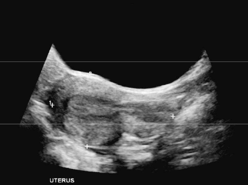 Due May 2023 - thread two