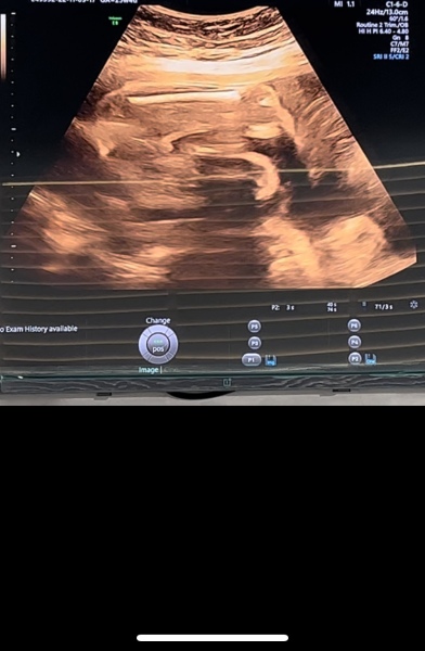 Gender guesses because I'm impatient!