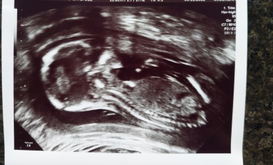 Scan pic- nub theory gender guesses for fun 💜💚