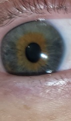 Eye pupil